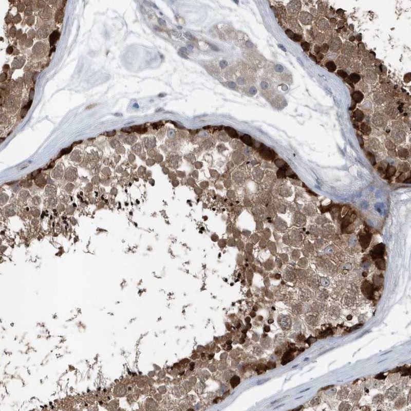 Staining of human testis shows strong cytoplasmic positivity in subset of cells in seminiferus ducts.