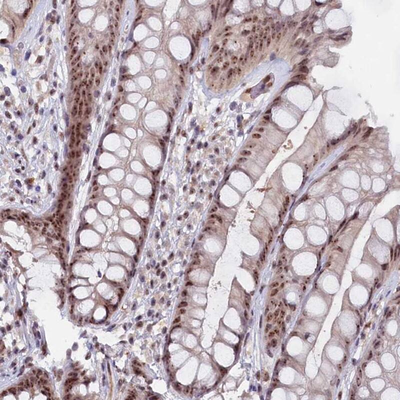 Staining of human rectum shows moderate nucleolar positivity in glandular cells.