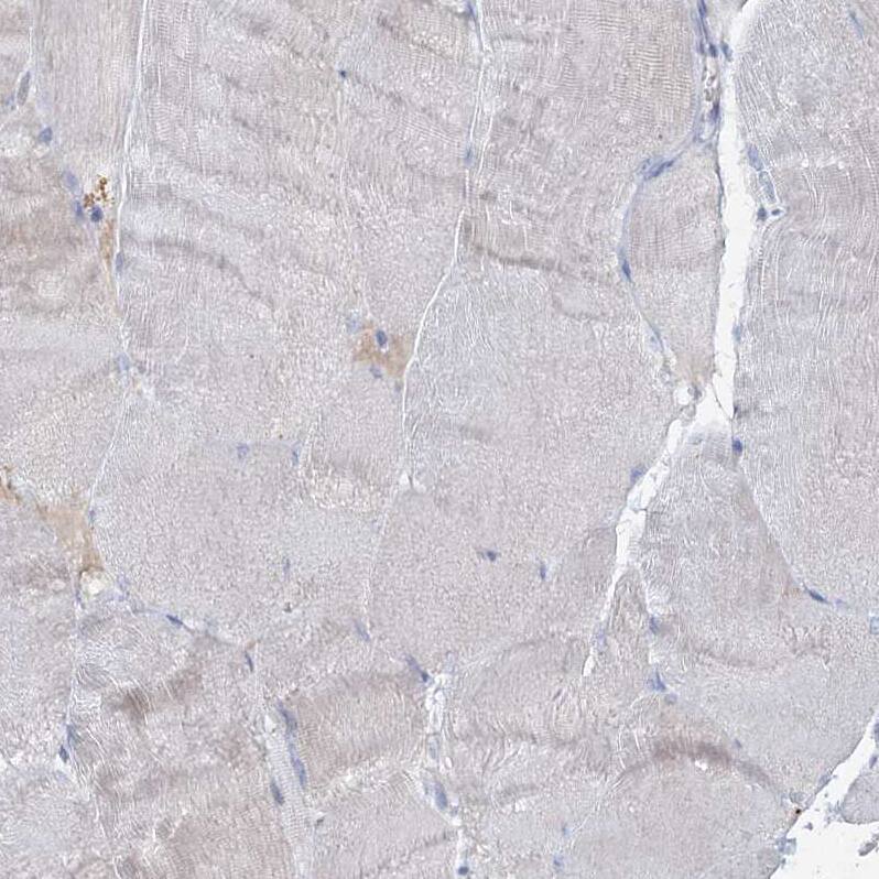 Immunohistochemistry-Paraffin RFX6 Antibody - BSA Free