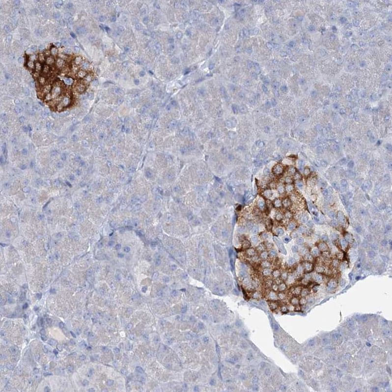 Staining of human pancreas shows strong cytoplasmic positivity in islets of Langerhans.
