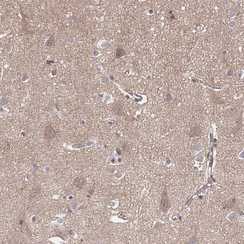 Staining of human cerebral cortex shows neuropil and cytoplasmic positivity in neurons.