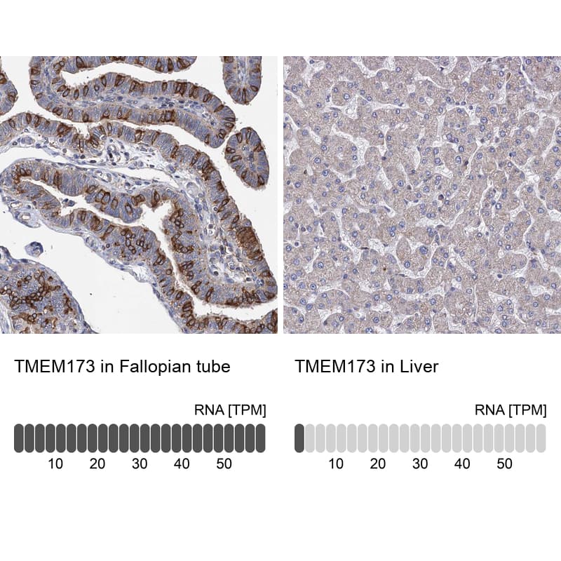 <b>Orthogonal Strategies Validation. </b>Analysis in human fallopian tube and liver tissues. Corresponding RNA-seq data are presented for the same tissues.