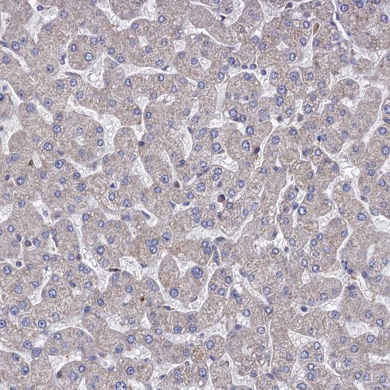 Staining of human liver shows no positivity in hepatocytes as expected.