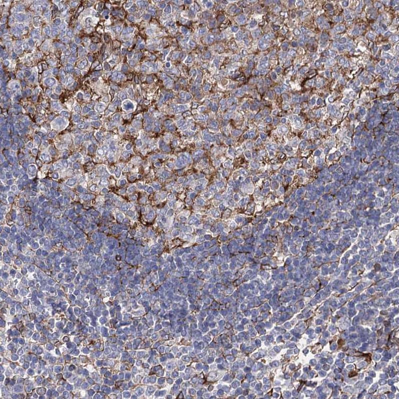 Staining of human lymph node shows strong membranous positivity in follicular dendritic cells.