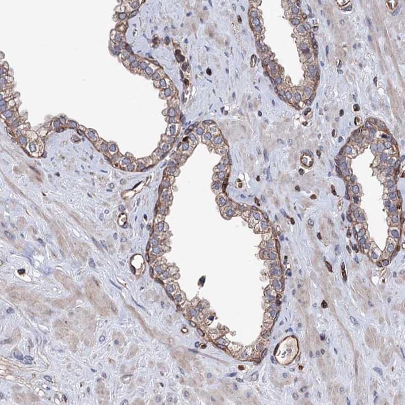 Staining of human prostate shows moderate membranous positivity in basal layer glandular cells.