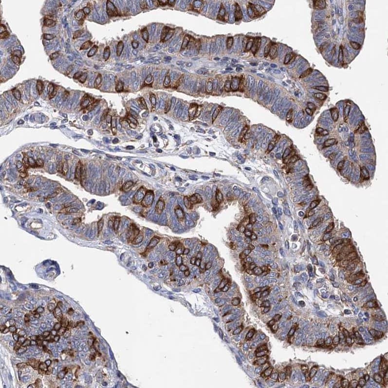 Staining of human Fallopian tube shows strong cytoplasmic and membranous positivity in glandular cells.
