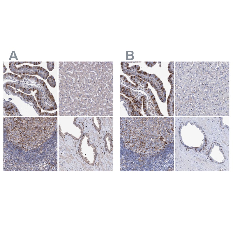 <b>Orthogonal Strategies Validation. </b>Staining of human fallopian tube, liver, lymph node and prostate HPA038534 (A) shows similar protein distribution across tissues to independent antibody HPA038116 (B).