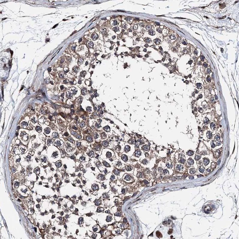 Staining of human testis shows strong cytoplasmic positivity in cells in seminiferous ducts.
