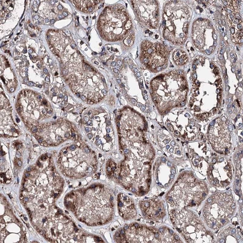 Staining of human kidney shows strong cytoplasmic positivity in cells in tubules.