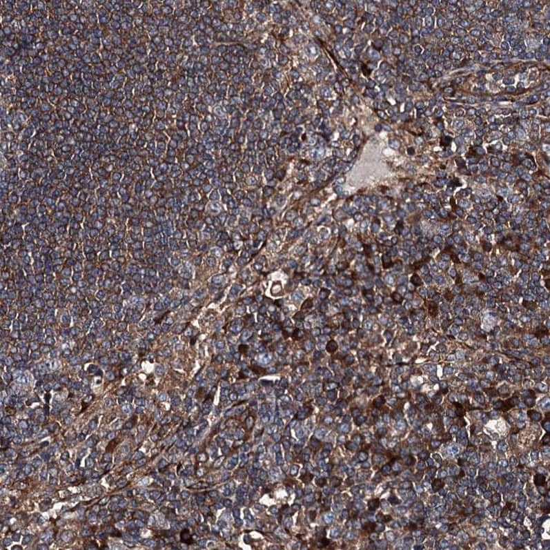 Staining of human lymph node shows strong cytoplasmic positivity in non-germinal center cells.