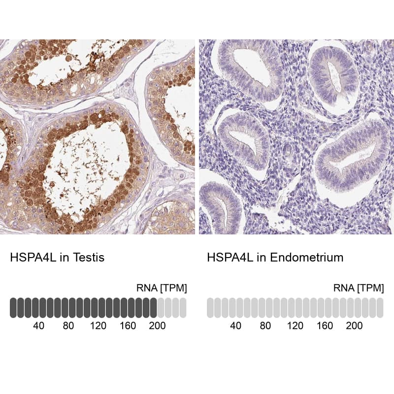 Immunohistochemistry-Paraffin HspA4L Antibody - BSA Free