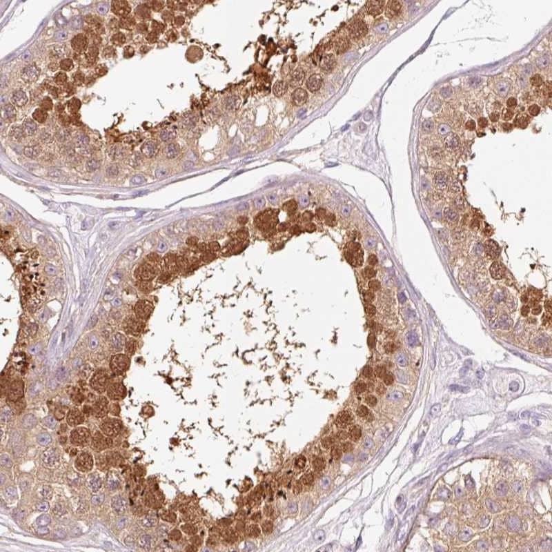 Staining of human testis shows high expression.