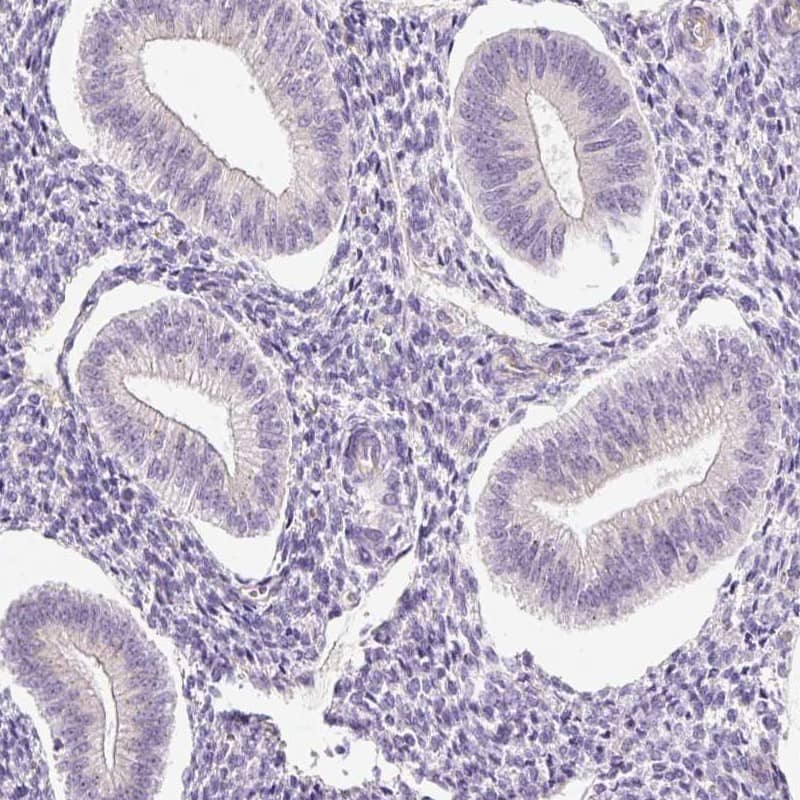 Staining of human endometrium shows low expression as expected.