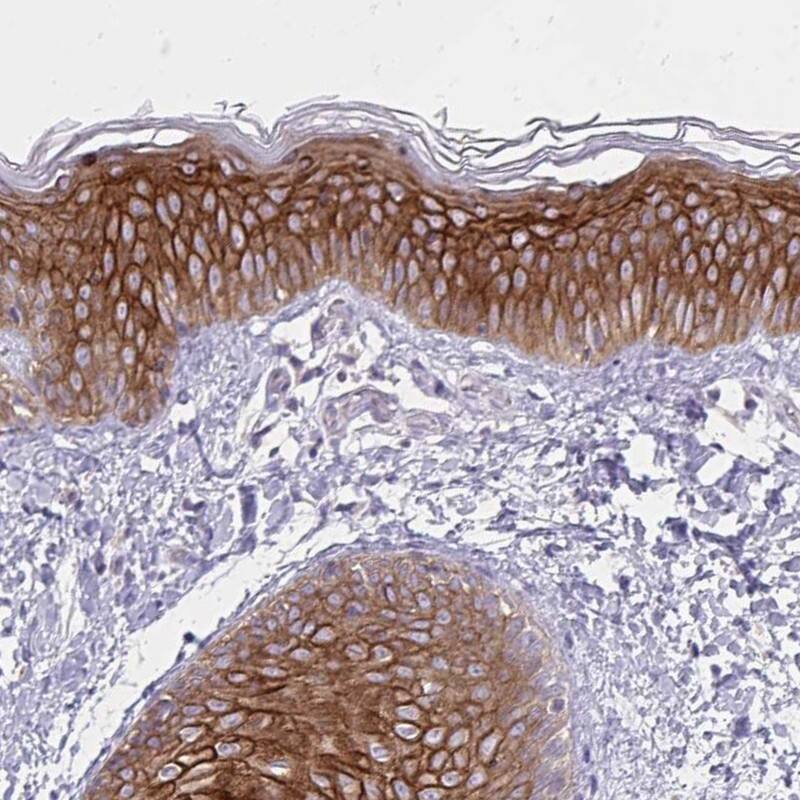 Staining of human skin shows high expression.