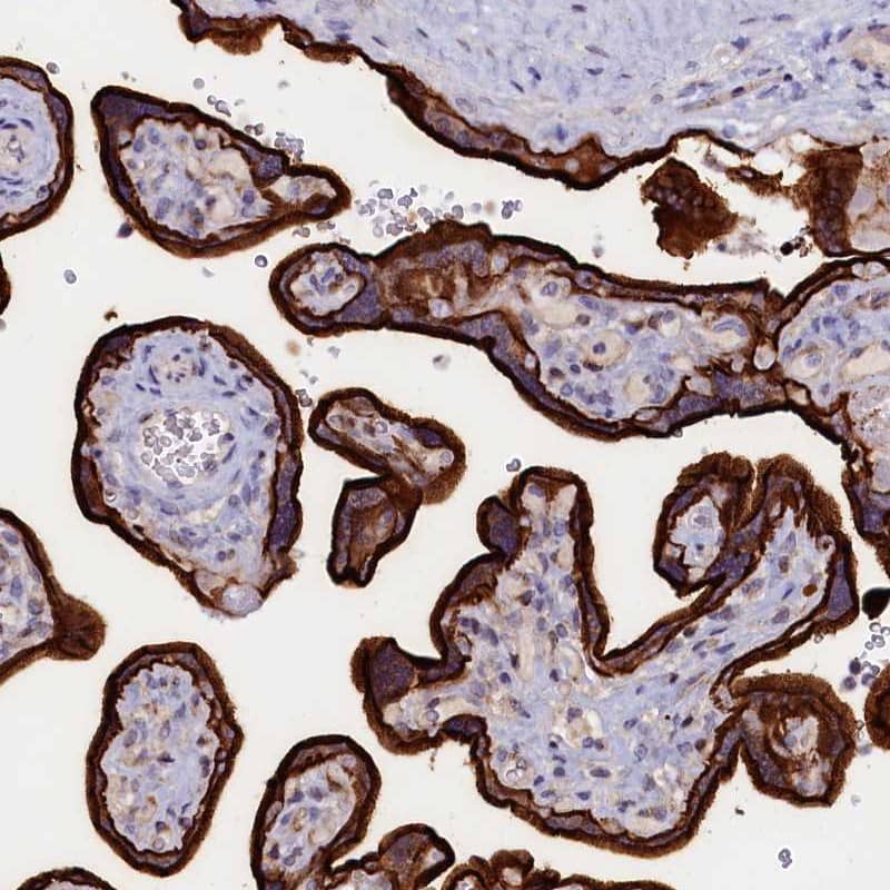 <b>Independent Antibodies Validation. </b>Staining of human placenta shows strong membranous and cytoplasmic positivity in trophoblastic cells.
