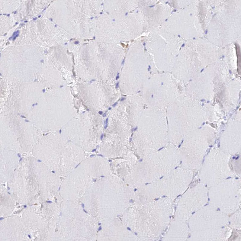Staining of human skeletal muscle shows no positivity in myocytes as expected.