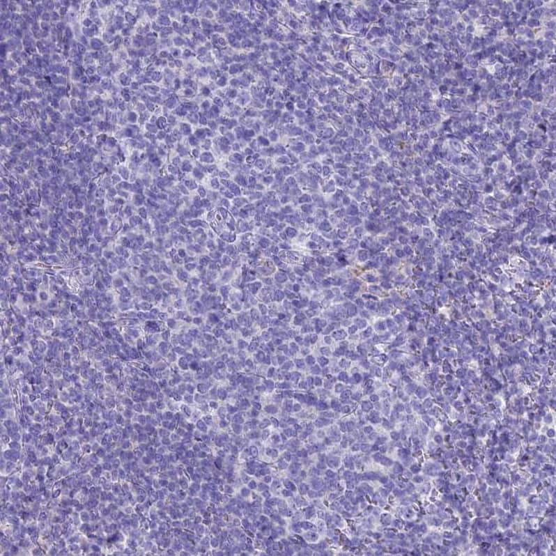Staining of human tonsil shows no positivity in germinal center cells as expected.