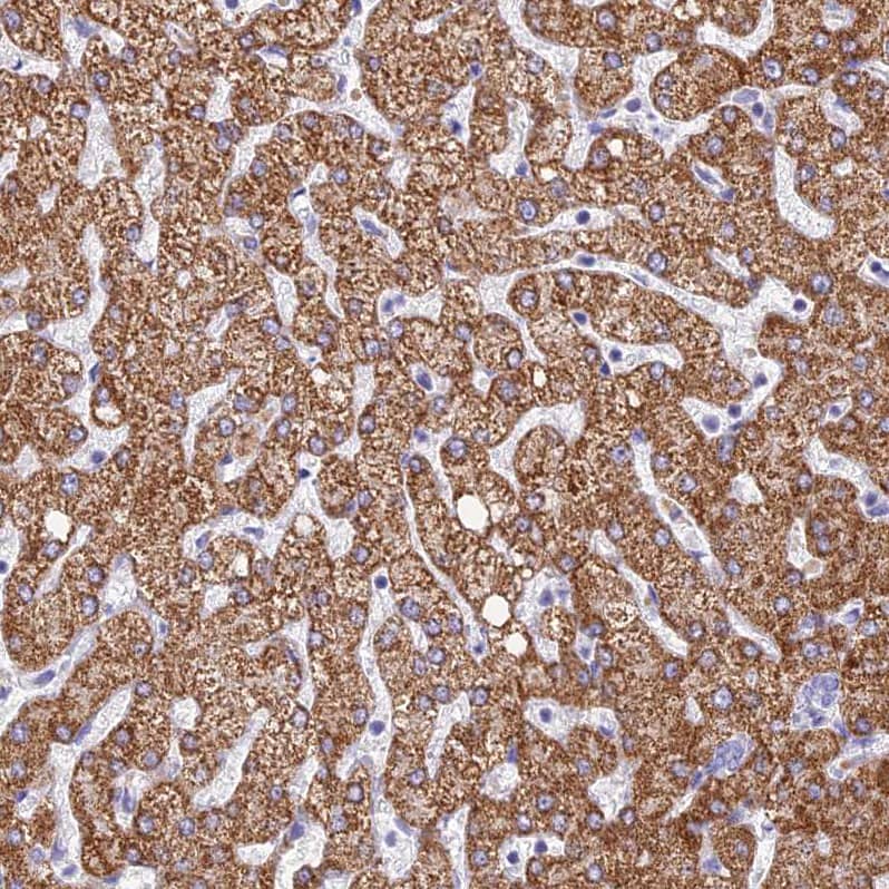 Staining of human liver shows strong granular cytoplasmic positivity in hepatocytes.