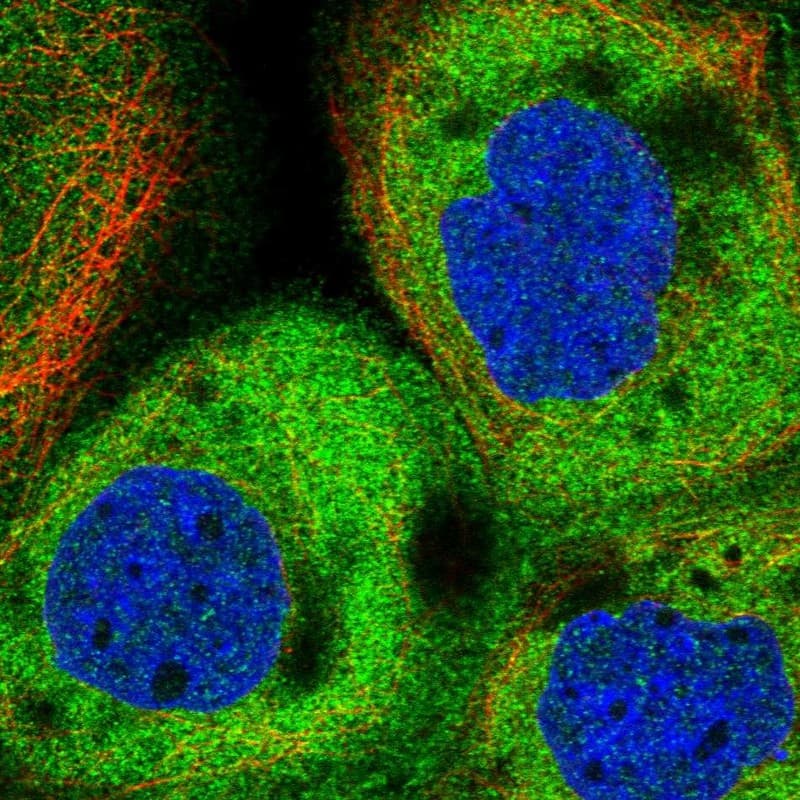 Staining of human cell line A-431 shows positivity in plasma membrane & cytoplasm.