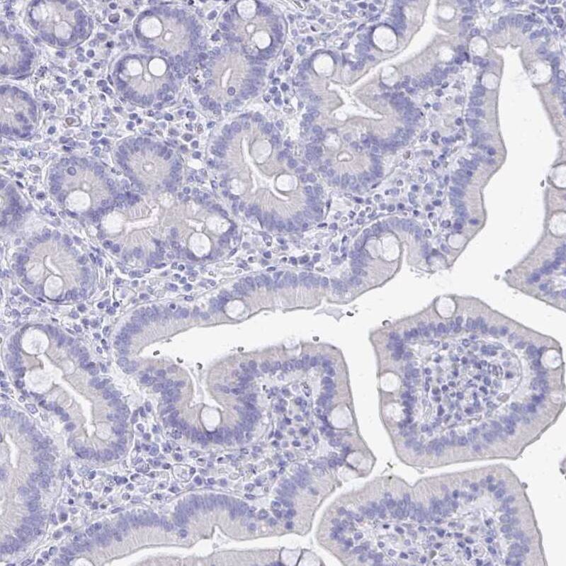 Staining of human duodenum shows no positivity in glandular cells as expected.