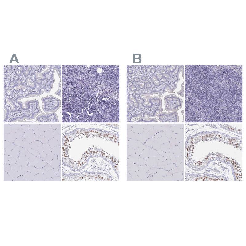 Staining of human gastrointestinal, lymphoid tissues, skeletal muscle and testis .