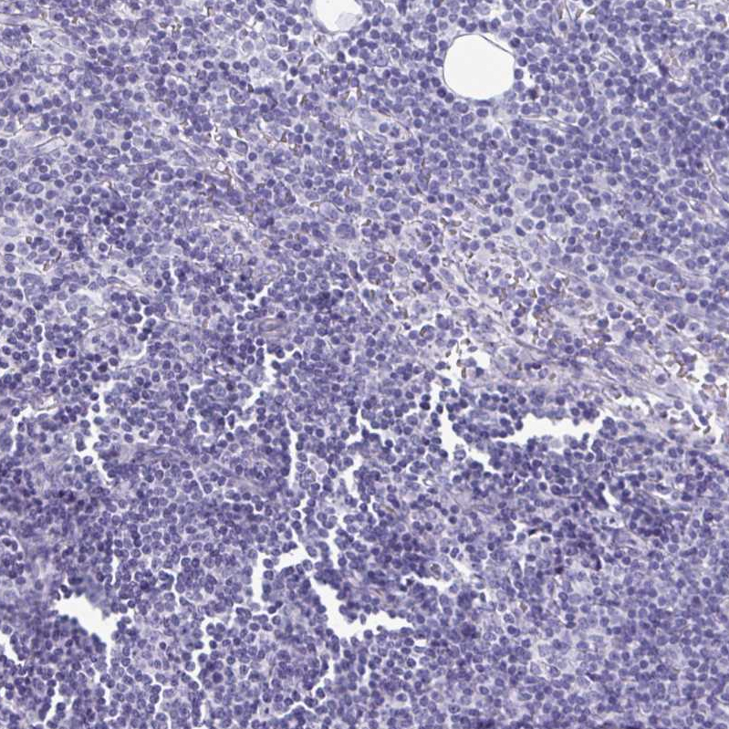 Staining of human lymph node shows no positivity in non-germinal center cells as expected.