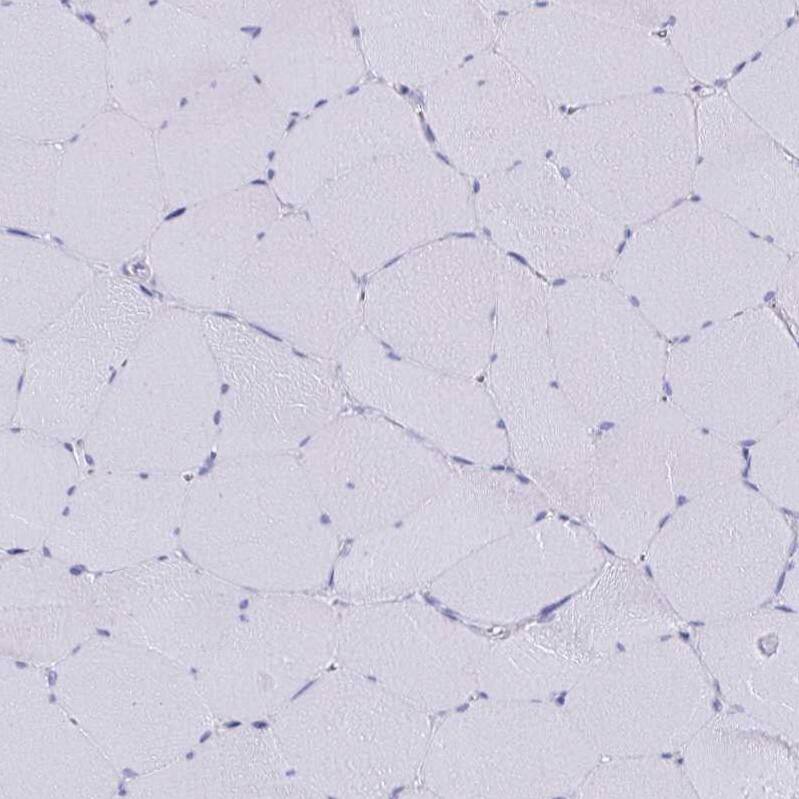 Staining of human skeletal muscle shows no positivity in myocytes as expected.