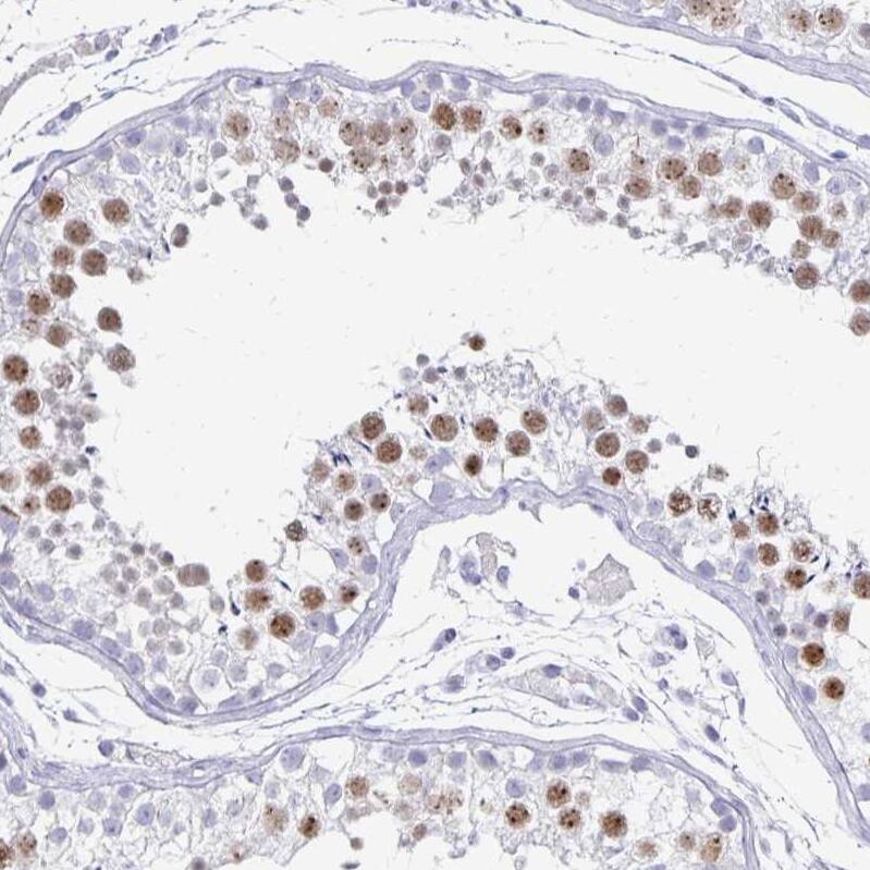 Staining of human testis shows strong nuclear and nucleoli positivity in cells in seminiferous ducts.