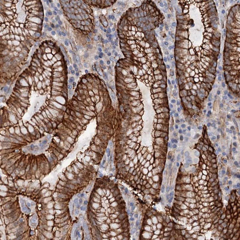 Immunohistochemistry-Paraffin C12orf76 Antibody - BSA Free