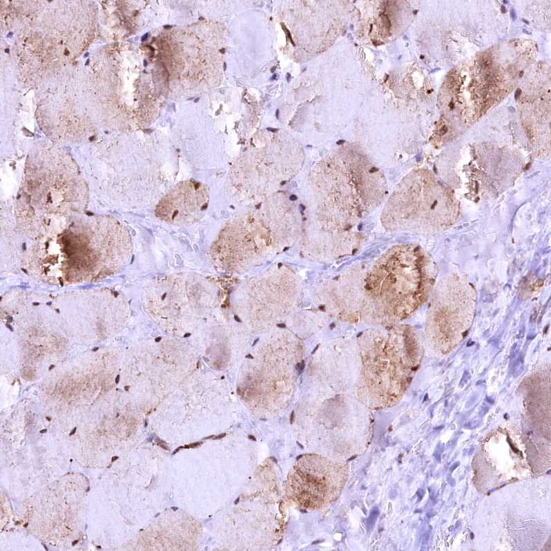 Staining of human skeletal muscle shows moderate nuclear and cytoplasmic positivity in myocytes.