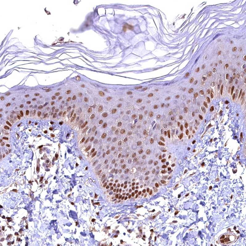 Staining of human skin shows moderate to strong nuclear positivity in squamous epithelial cells.