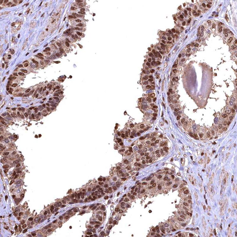 Staining of human prostate shows moderate to strong nuclear and cytoplasmic positivity in glandular cells.