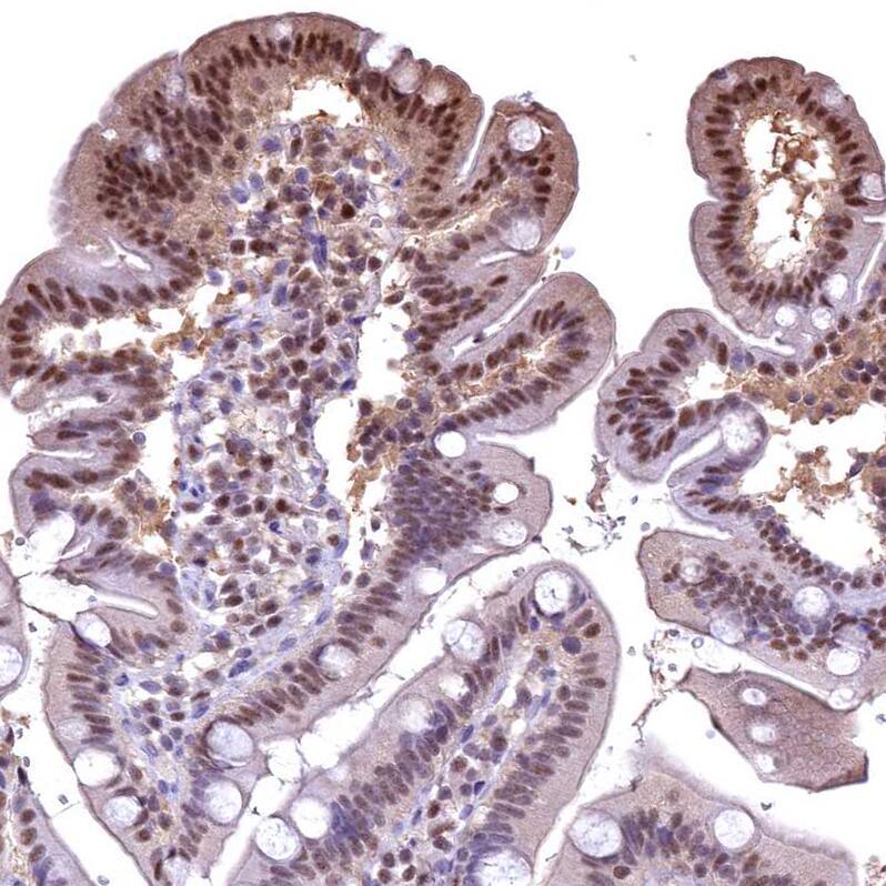 Staining of human gastrointestinal shows moderate nuclear and cytoplasmic positivity in glandular cells.
