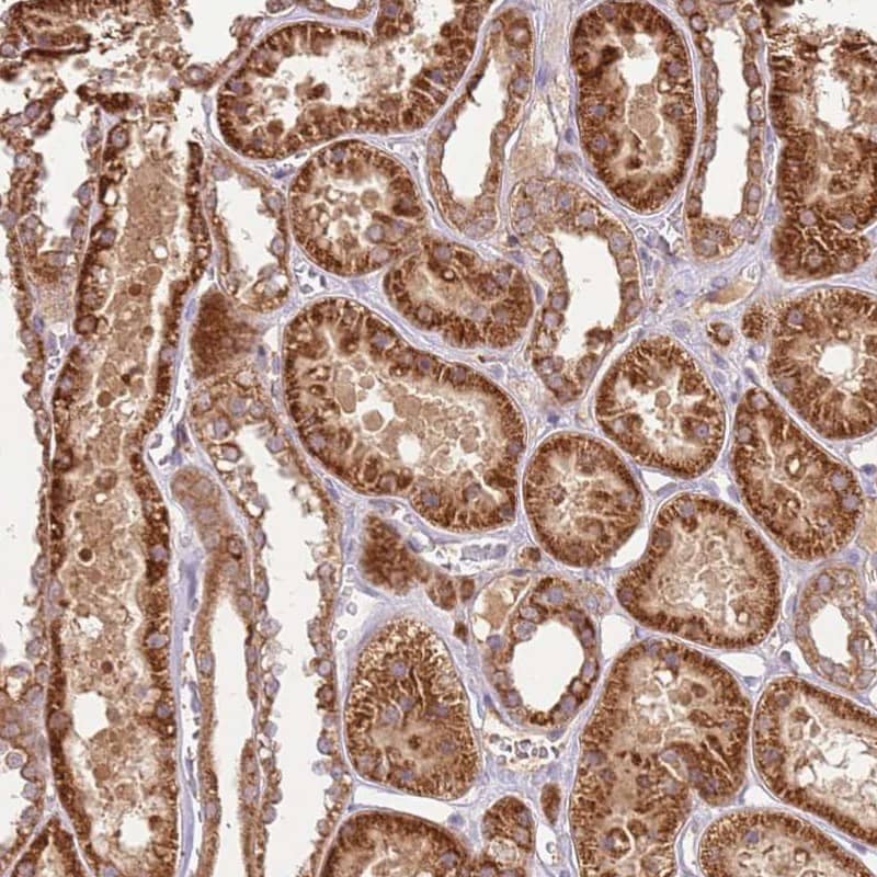Immunohistochemistry-Paraffin LRRC28 Antibody - BSA Free