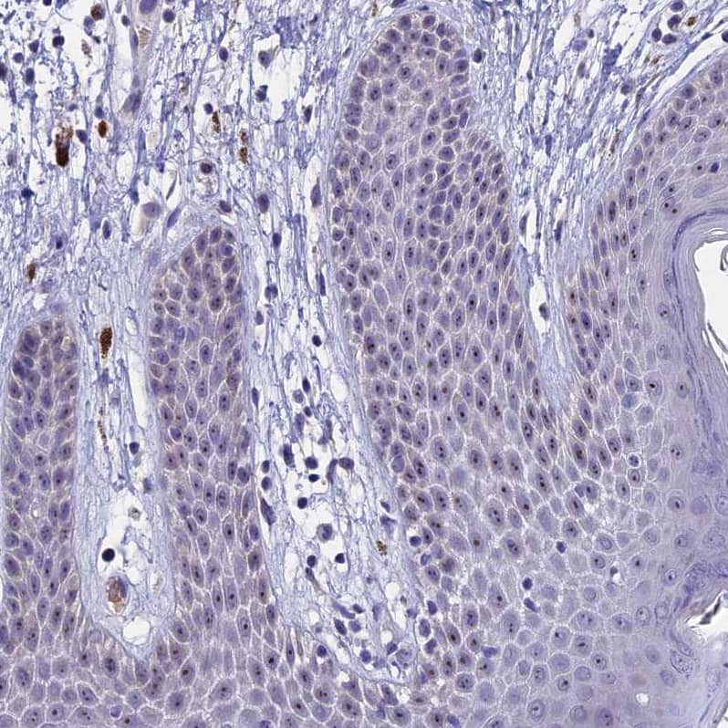 Staining of human skin shows strong positivity in nucleoli in squamous epithelial cells.