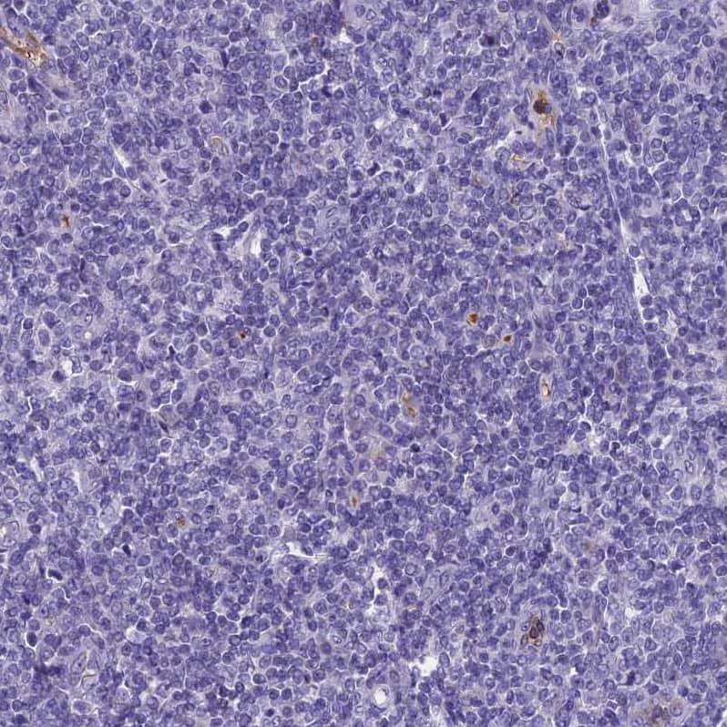 Staining of human tonsil shows no positivity in non-germinal center cells as expected.