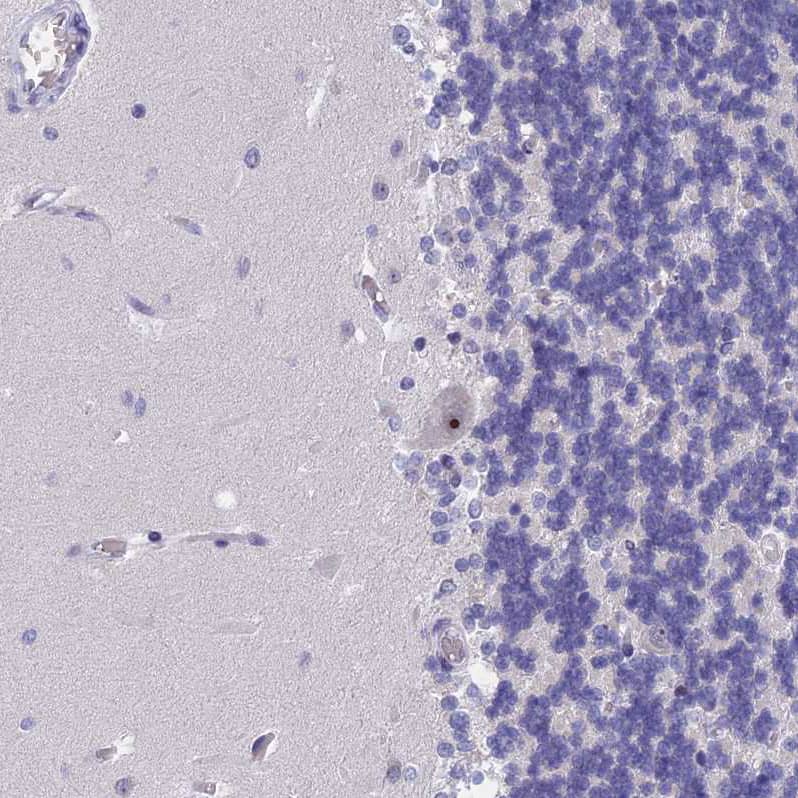 Staining of human cerebellum shows strong positivity in nucleoli in Purkinje cells.