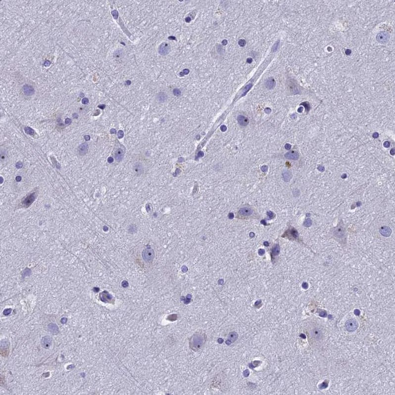 Staining of human cerebral cortex shows moderate positivity in nucleoli in neurons.