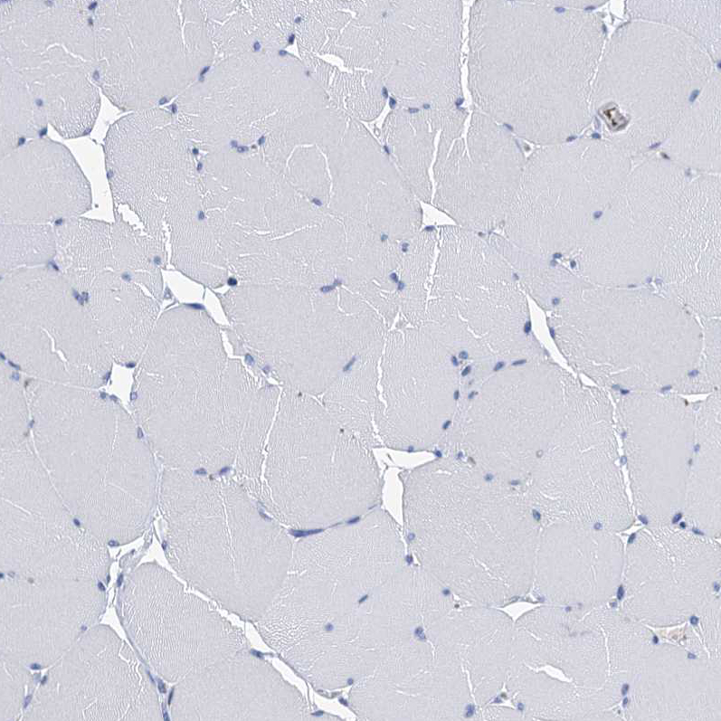 Immunohistochemistry-Paraffin CYP51A1 Antibody - BSA Free