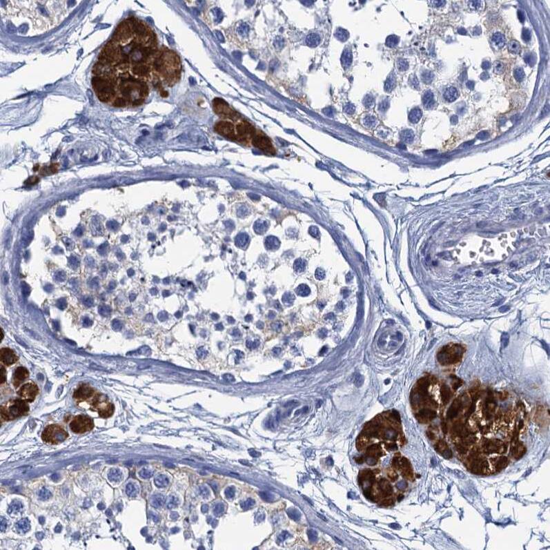 Staining of human testis shows weak to moderate cytoplasmic positivity in Leydig cells.