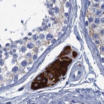 Staining of human testis.