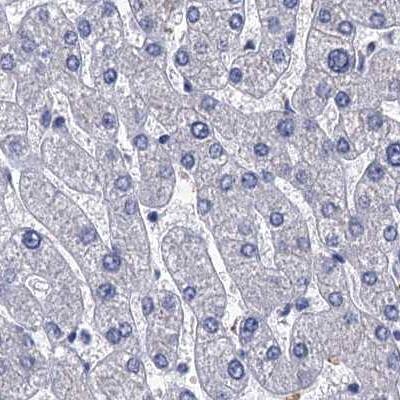 Staining of human liver.