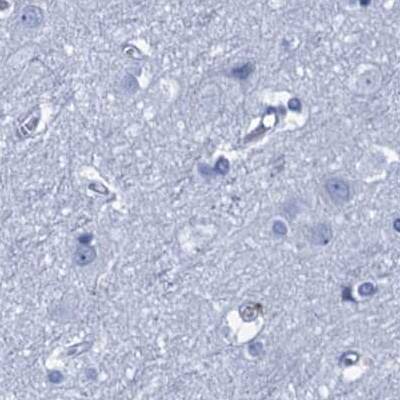 Staining of human cerebral cortex.