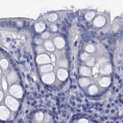 Staining of human colon.
