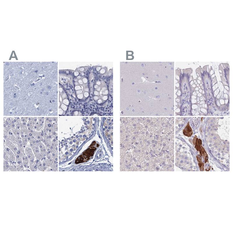 <b>Orthogonal Strategies Validation. </b>Staining of human cerebral cortex, colon, liver and testis HPA041325 (A) shows similar protein distribution across tissues to independent antibody HPA043508 (B).