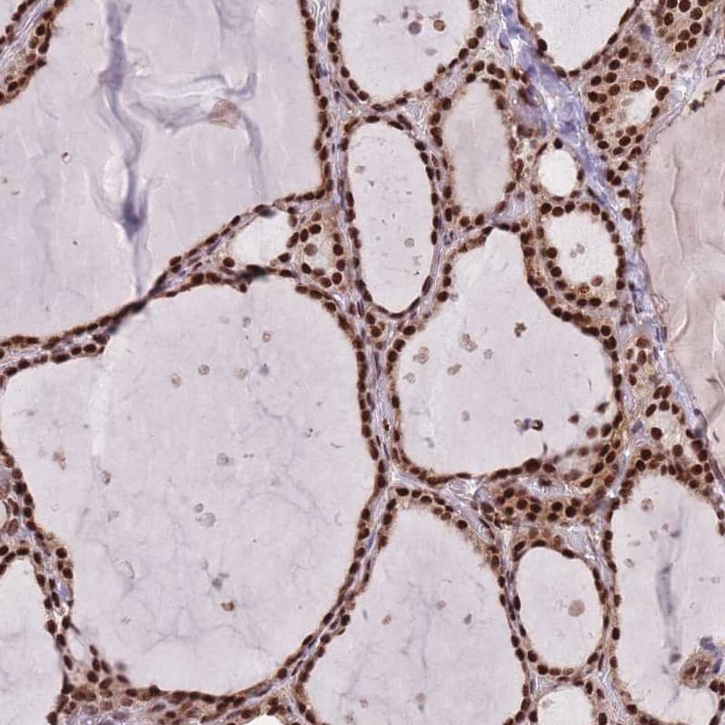 Staining of human thyroid gland shows nuclear positivity in glandular cells.
