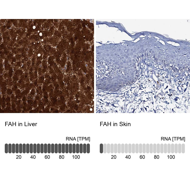 <b>Orthogonal Strategies Validation. </b>Analysis in human liver and skin tissues. Corresponding RNA-seq data are presented for the same tissues.