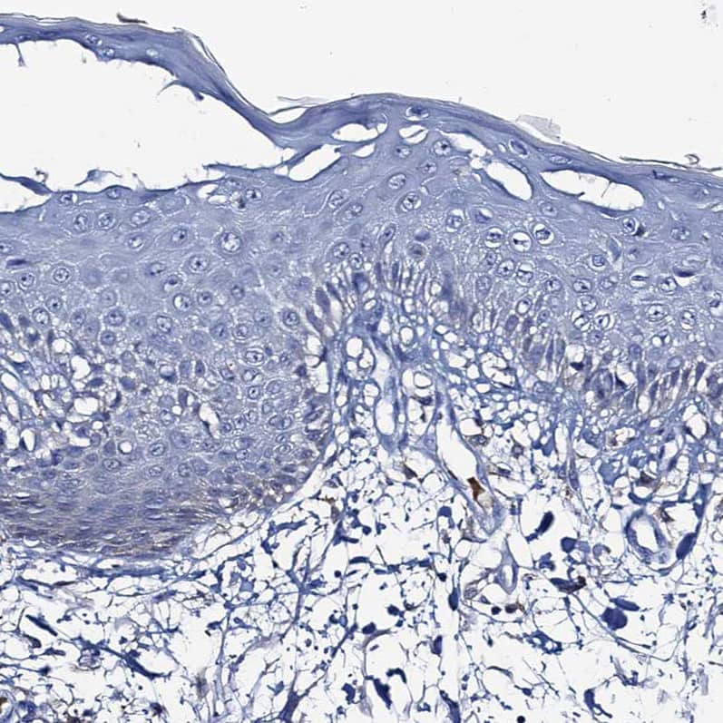 Staining of human skin shows no positivity in squamous epithelial cells as expected.