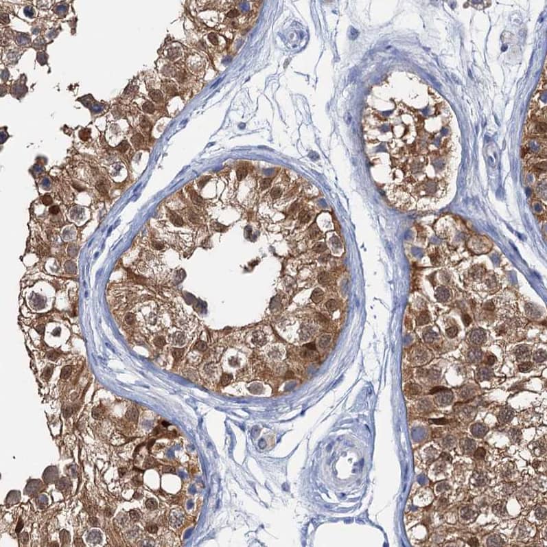 Staining of human testis shows moderate cytoplasmic-nucleus positivity in cells in seminiferous ducts.