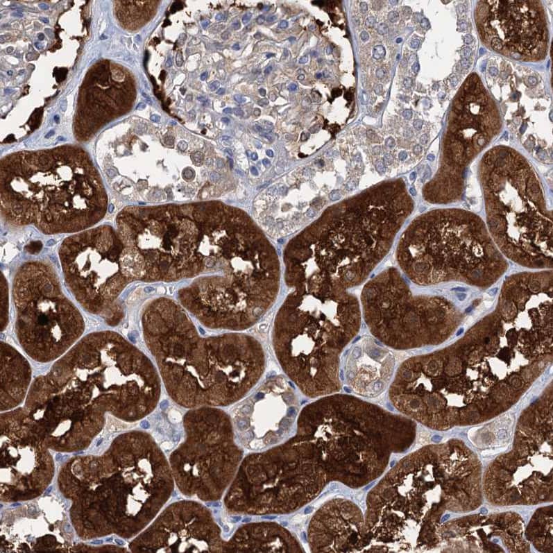 Staining of human kidney shows strong cytoplasmic-nucleus positivity in cells in tubules.